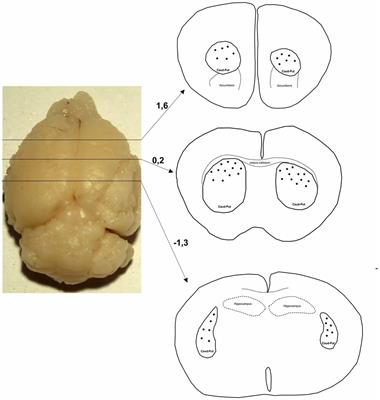 A Quantitative Golgi Study of Dendritic Morphology in the Mice Striatal Medium Spiny Neurons